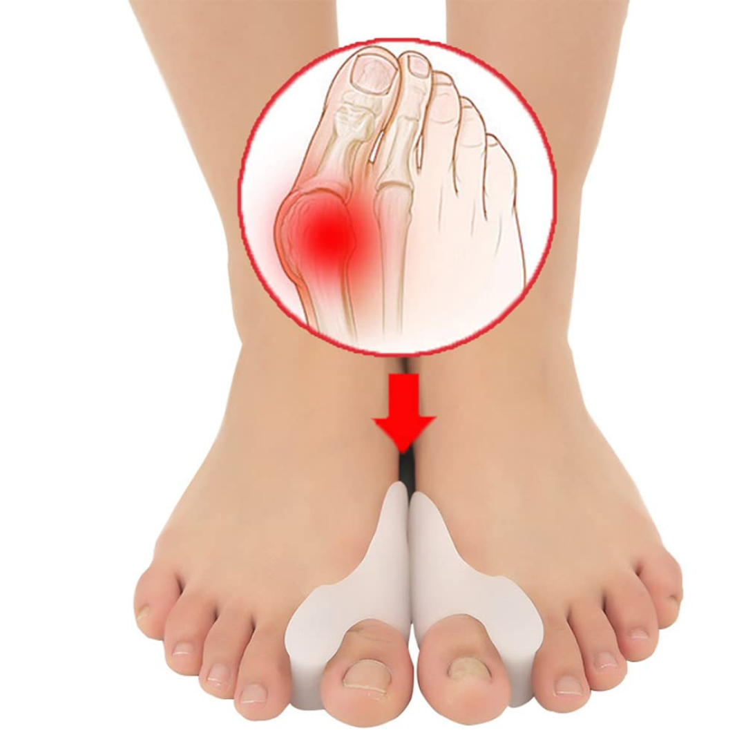 Hallux Valgus Corrector