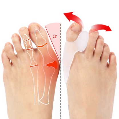 Hallux Valgus Corrector